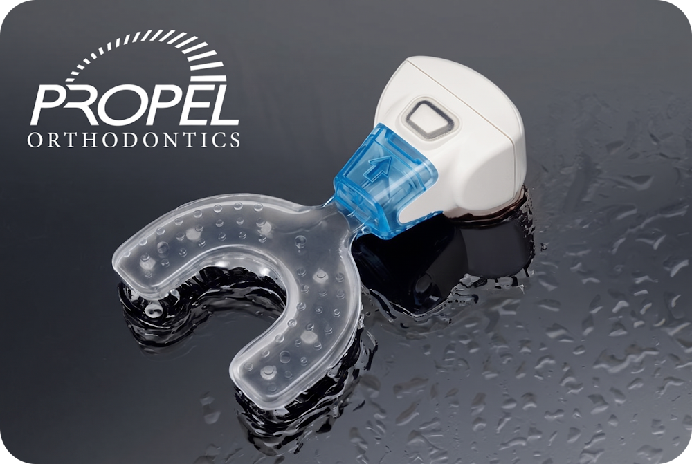 Propel Orthodontic Technology