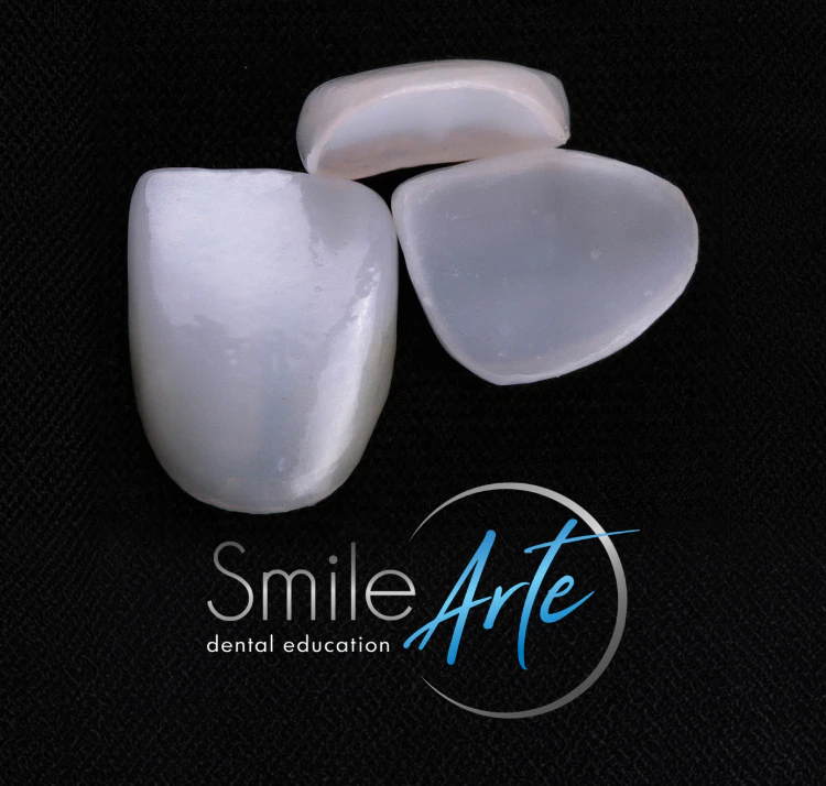 Smile Arte Dental Education veneers