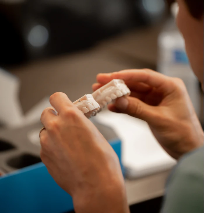 Smile Arte hands holding veneers model