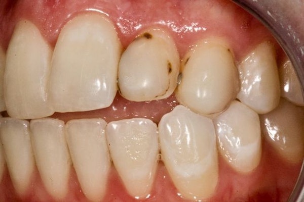 before cosmetic dentistry