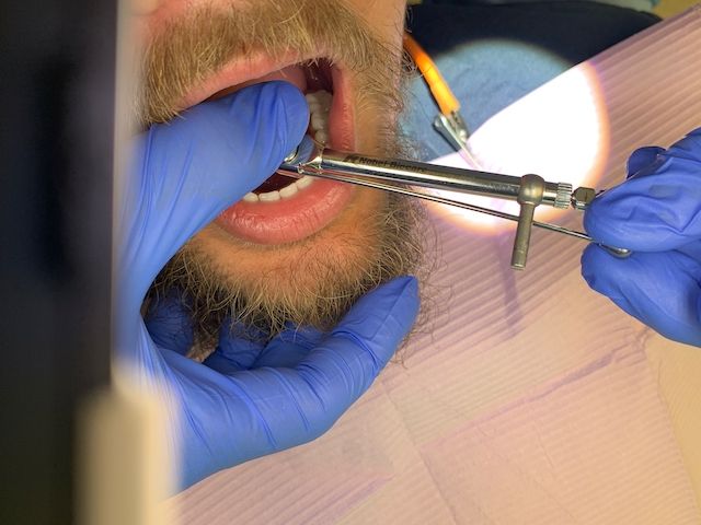 Close-up of a dentist working in a patient's mouth
