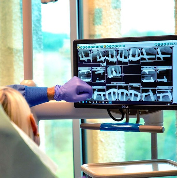 dental implants xray