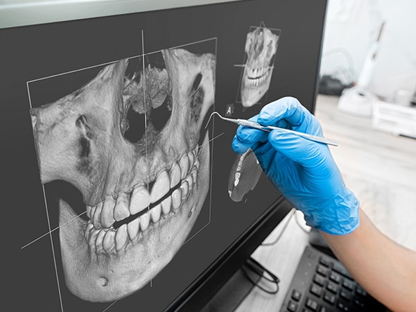 dentist examining an x-ray of the jawbone