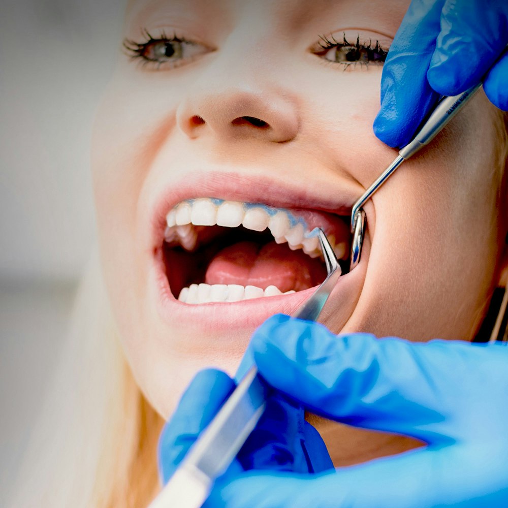 Patient getting teeth cleaning