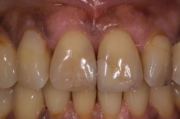 ​Before Smile Makeover