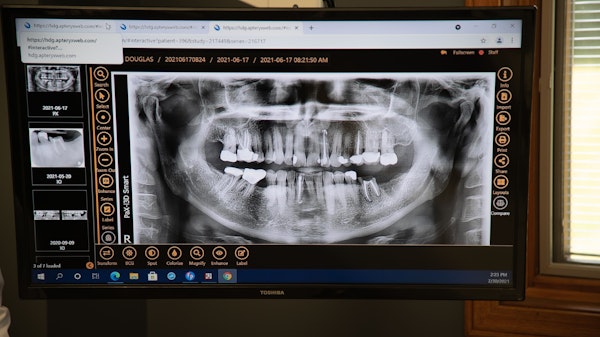 Dental x-ray