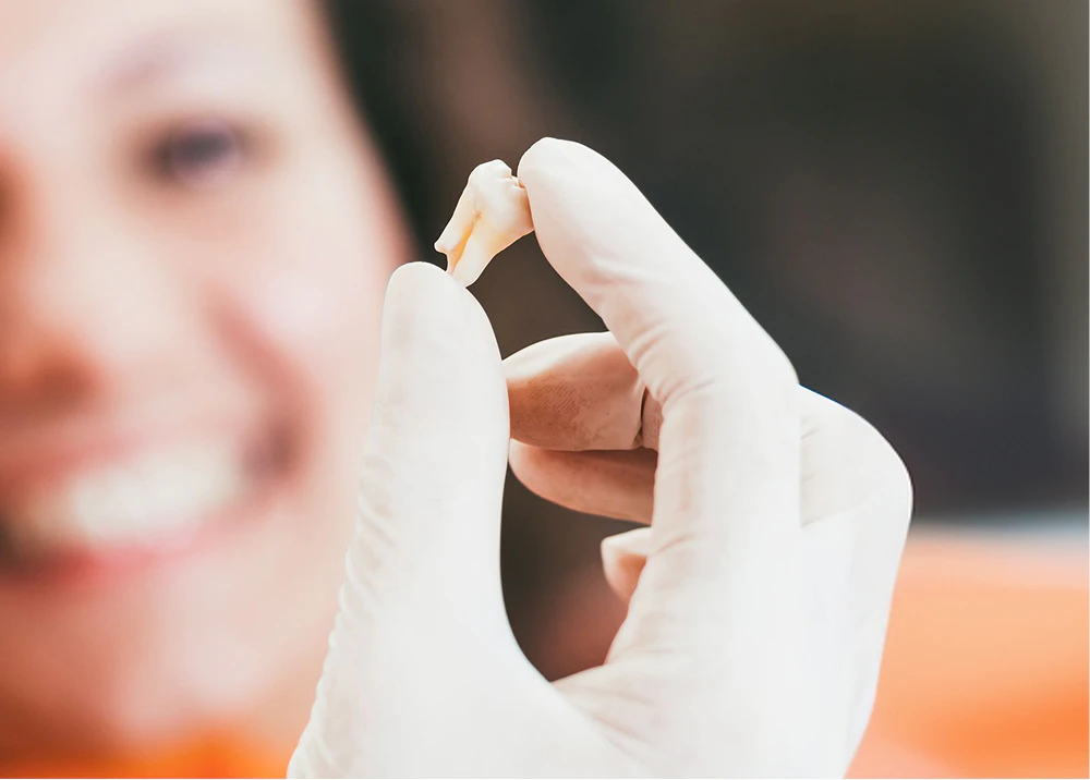Extracted Tooth
