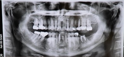 Dental x-ray