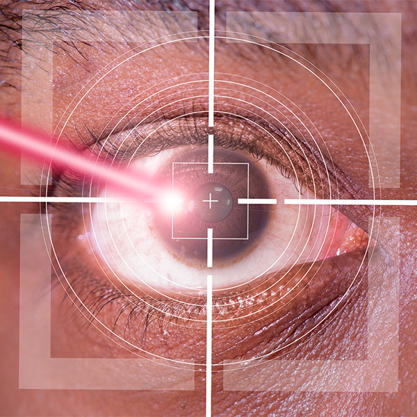Laser eye surgery