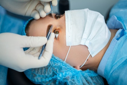 Woman getting LASIK