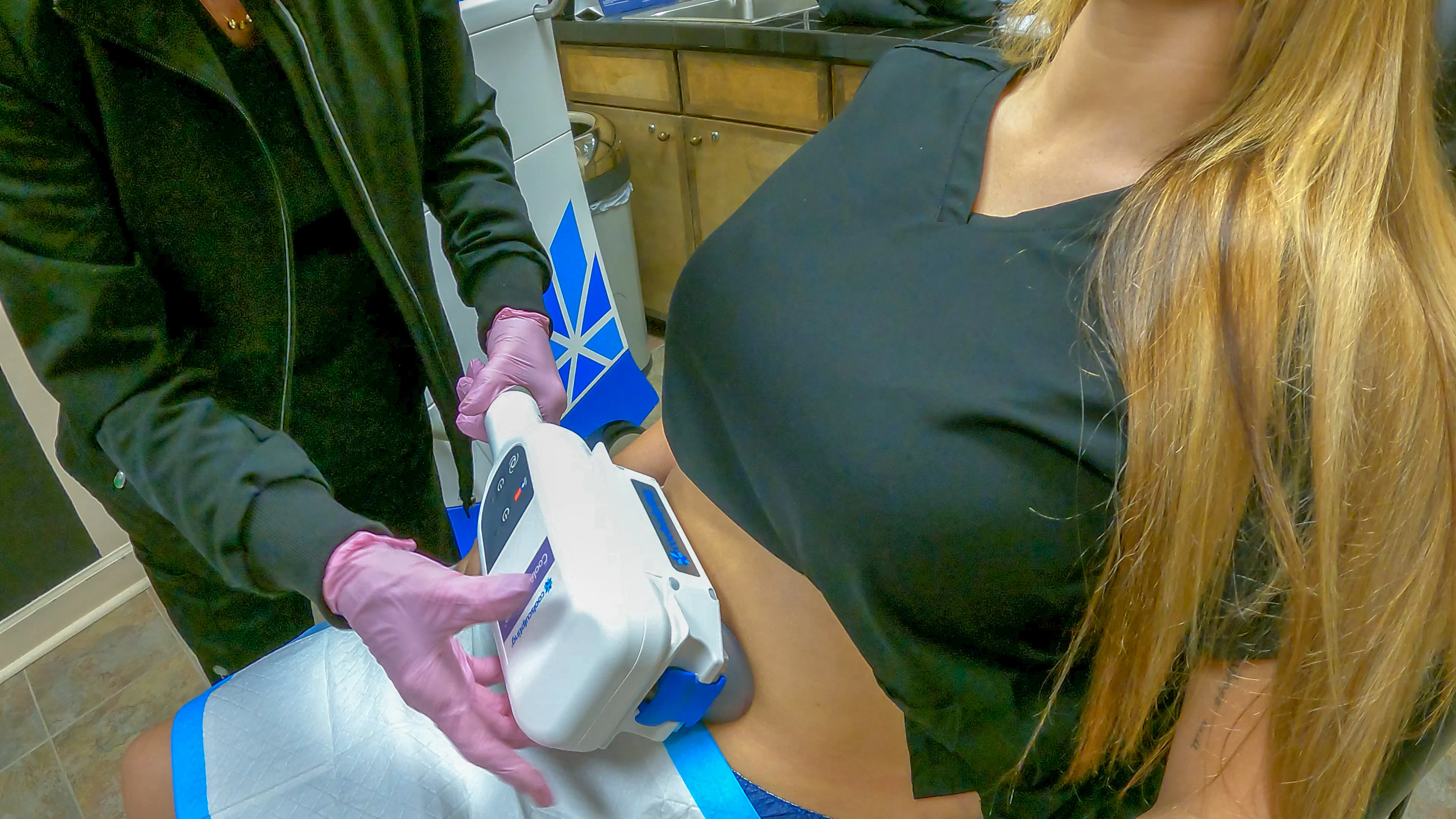 Woman undergoing Coolsculpting treatment