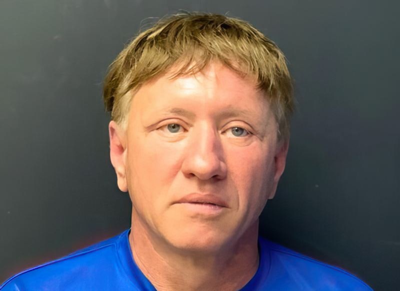 Case 8 after blepharoplasty