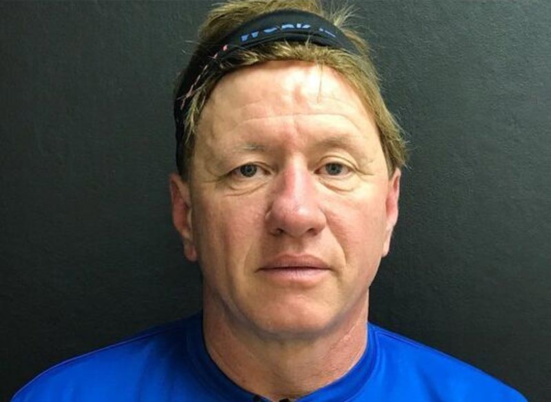 Case 8 before blepharoplasty