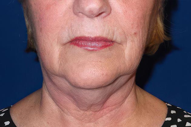 Dr. Spencer R. Anderson's patient before treatment