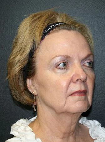 Dr. Jain