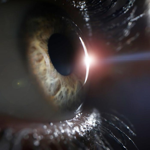 Laser going into an eyeball