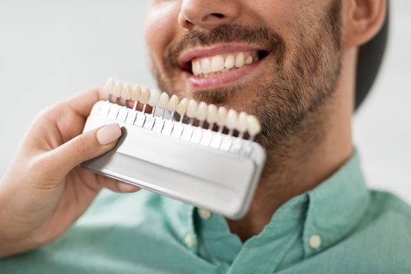 A dentist holding up teeth in various colors so veneers can be color-matched
