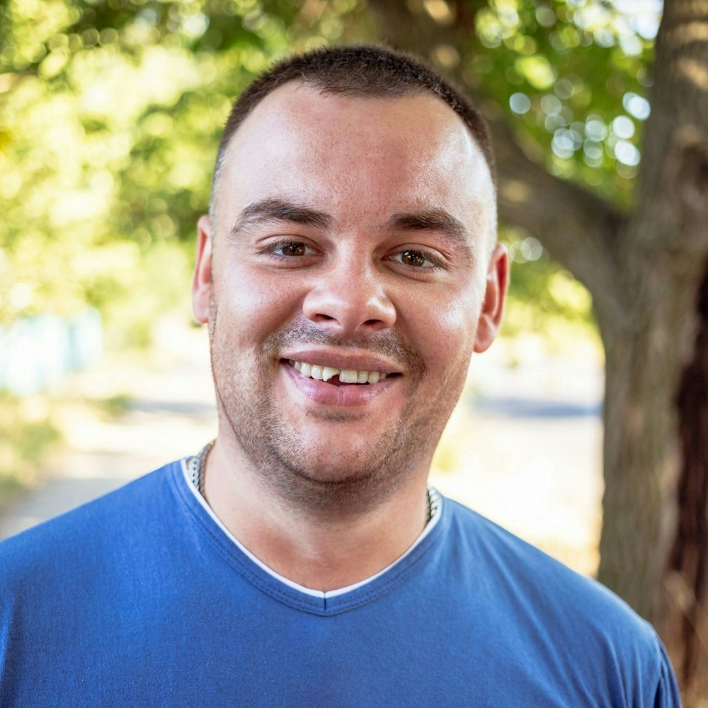 Chipped tooth and man