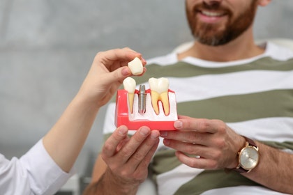 doctor showing patient a dental implant model
