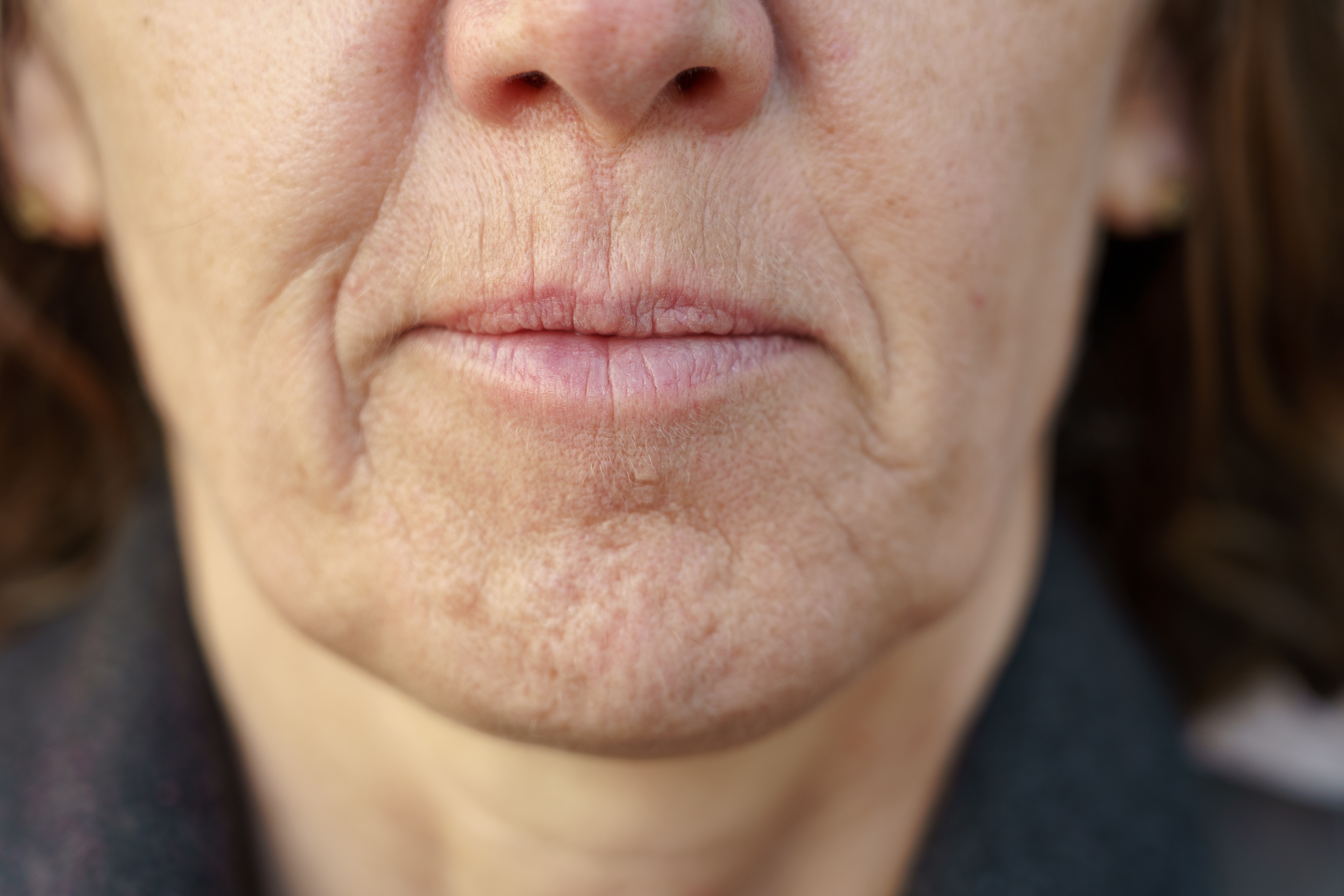 woman with lines around her mouth
