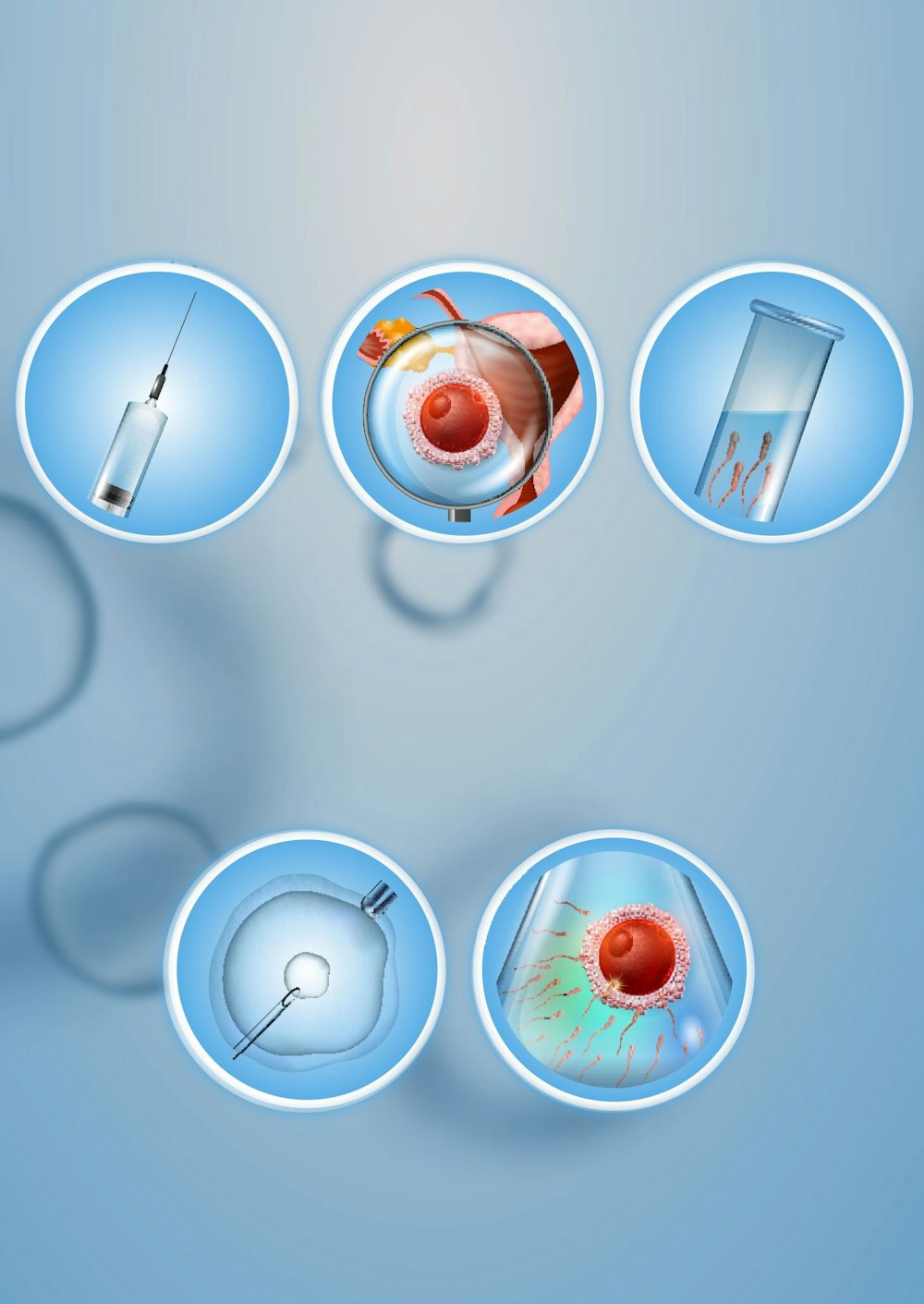 In Vitro Fertilization (IVF)