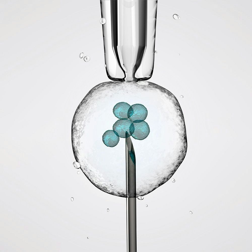 In Vitro Fertilization procedure