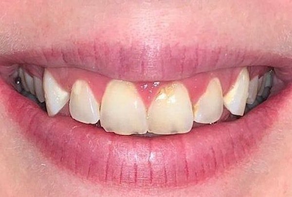 Case #15 before procedure