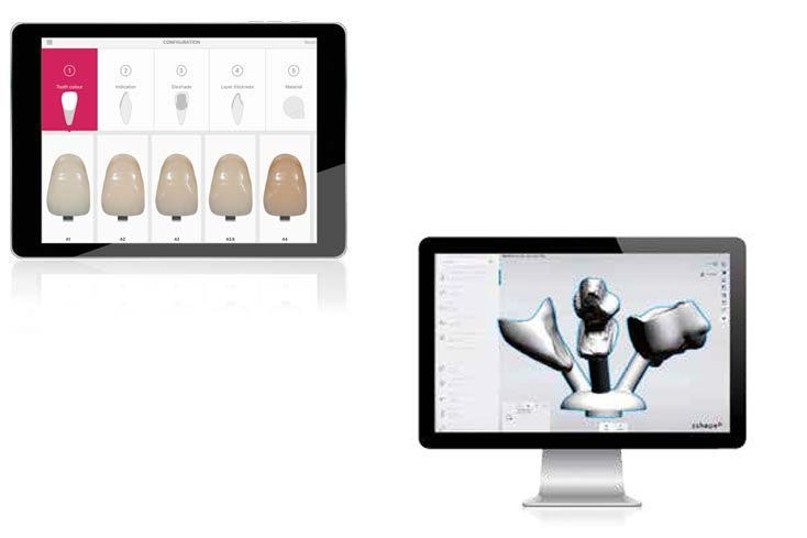 Computer monitors with dental software