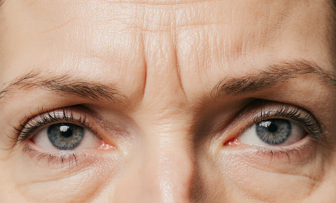 Close-up of woman's eyes to show her frown lines