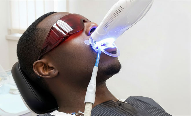 Man getting his teeth professionally whitened
