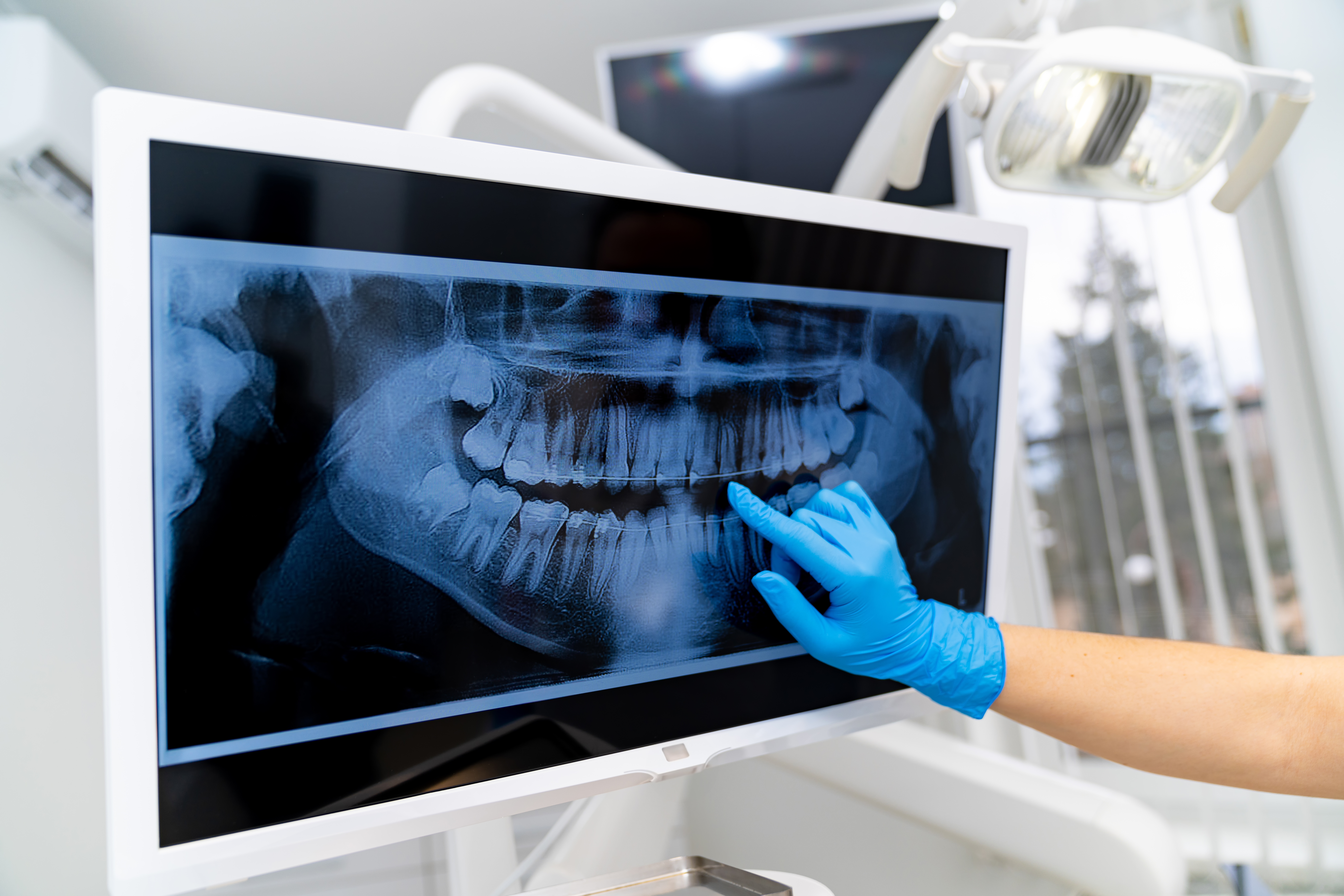 Dental X-ray