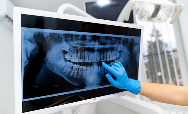 Dental X-ray