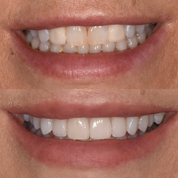 Amy's before and after