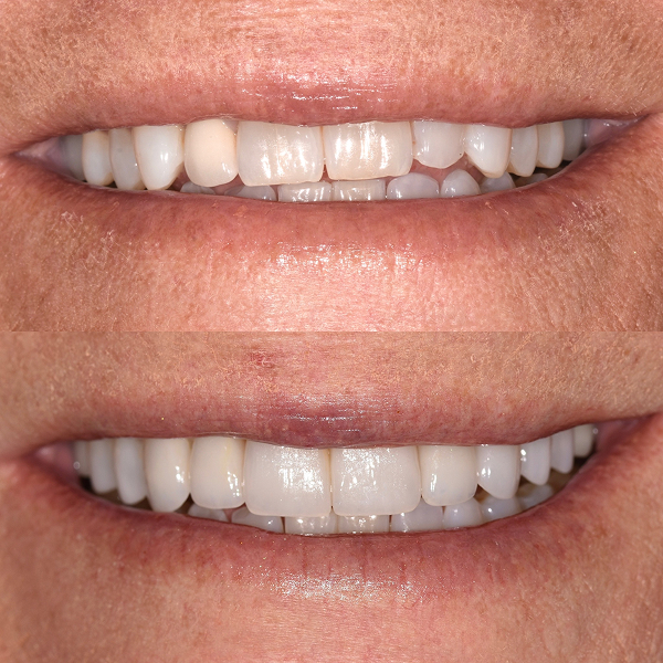 Lisa's before and after