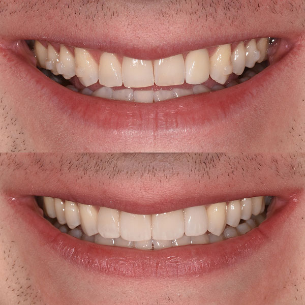 Will before and after
