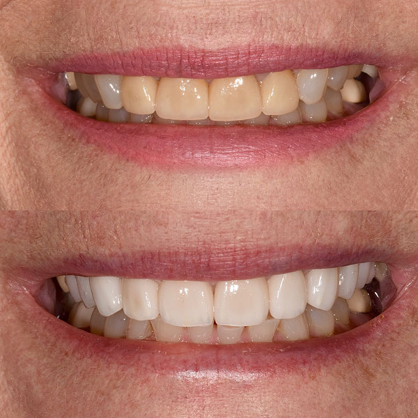 Christine before and after