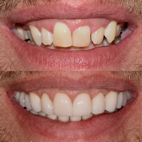 Daniel before and after