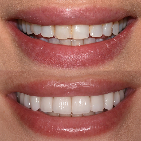 Amanda before and after