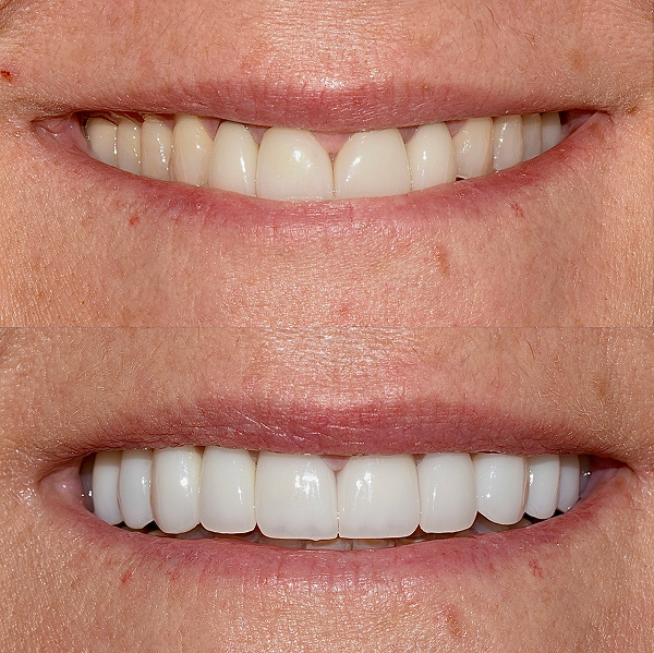 Tammy before and after
