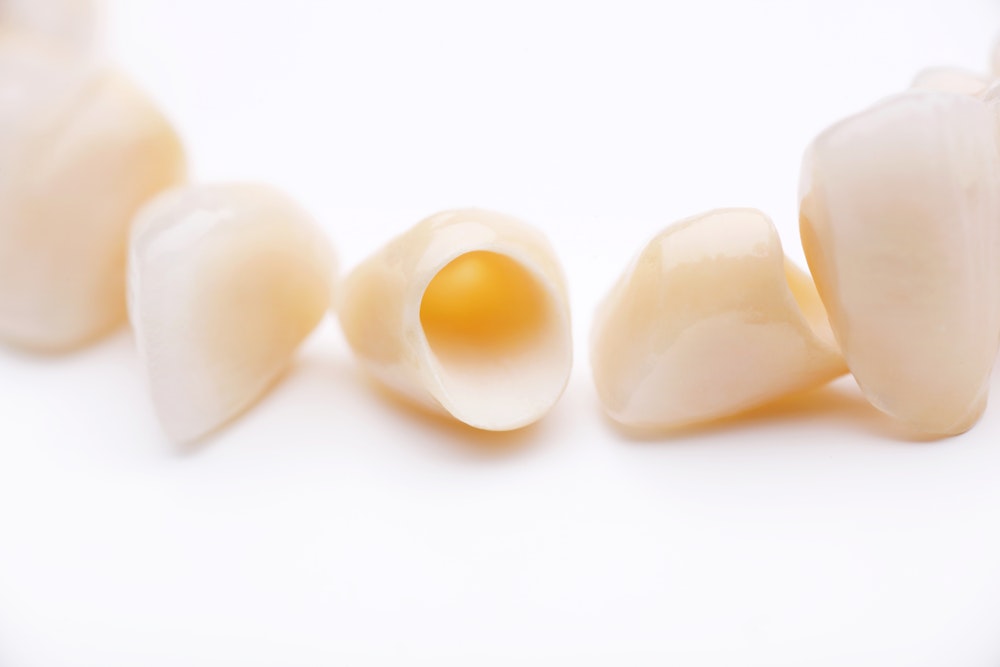 A row of dental crowns