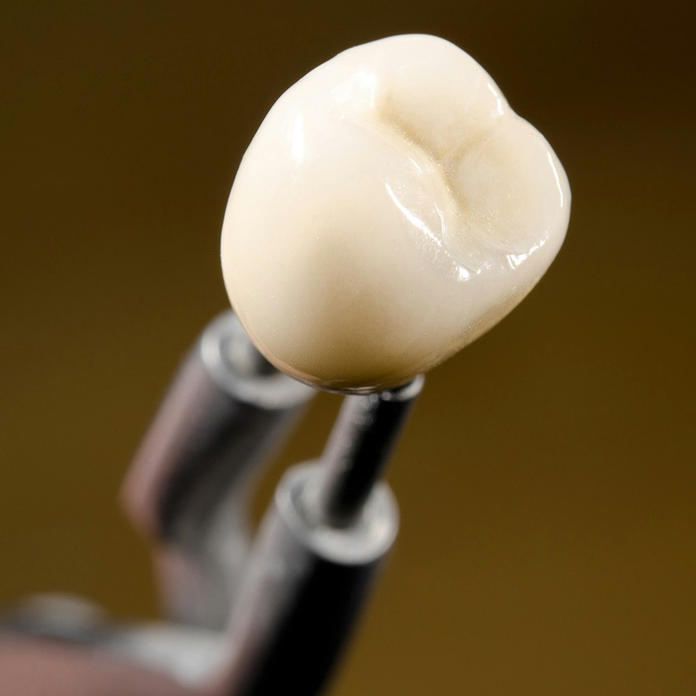 Dental Crown