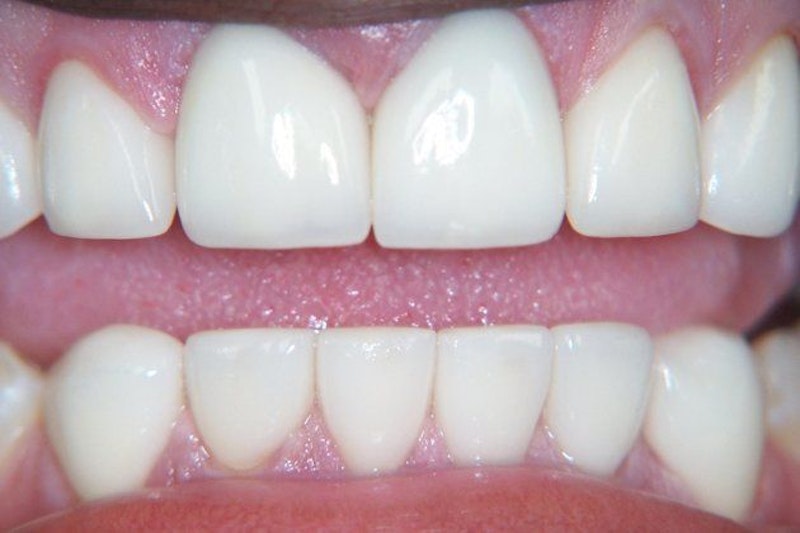 Clint Newman, DDS, patient after a smile makeover