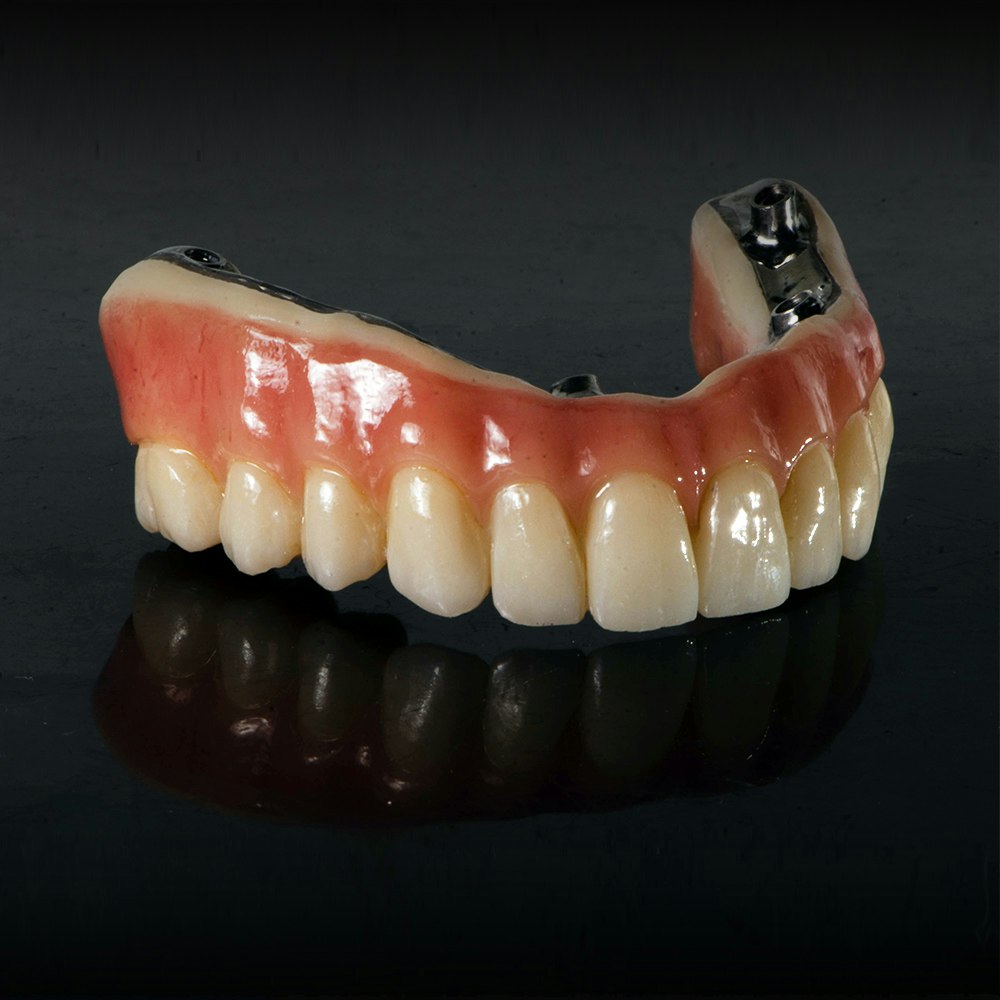 Implantable Dentures