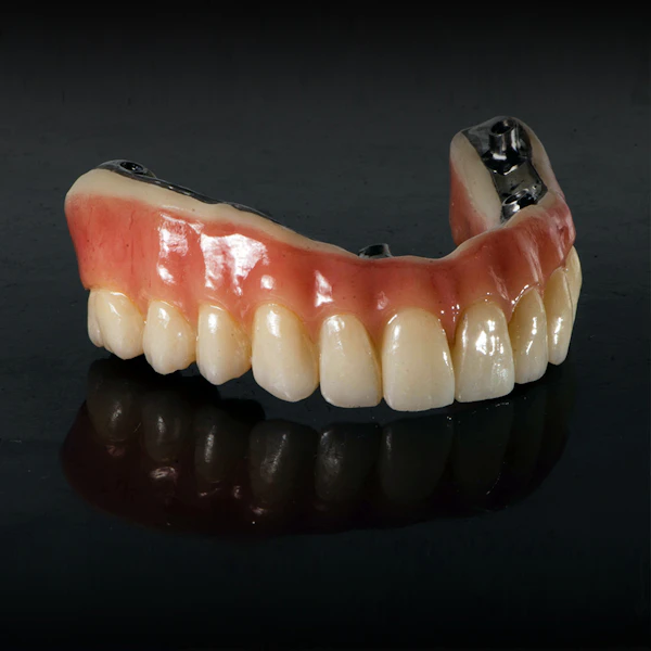 Full-arch implant-supported denture