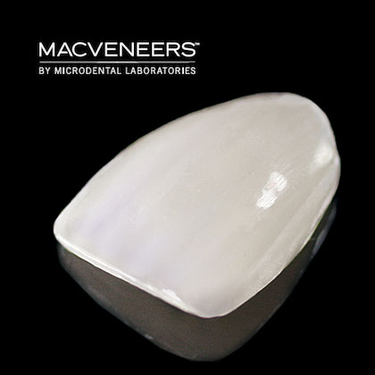 MAC Veneers