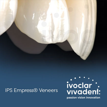 IPS Empress® Veneers