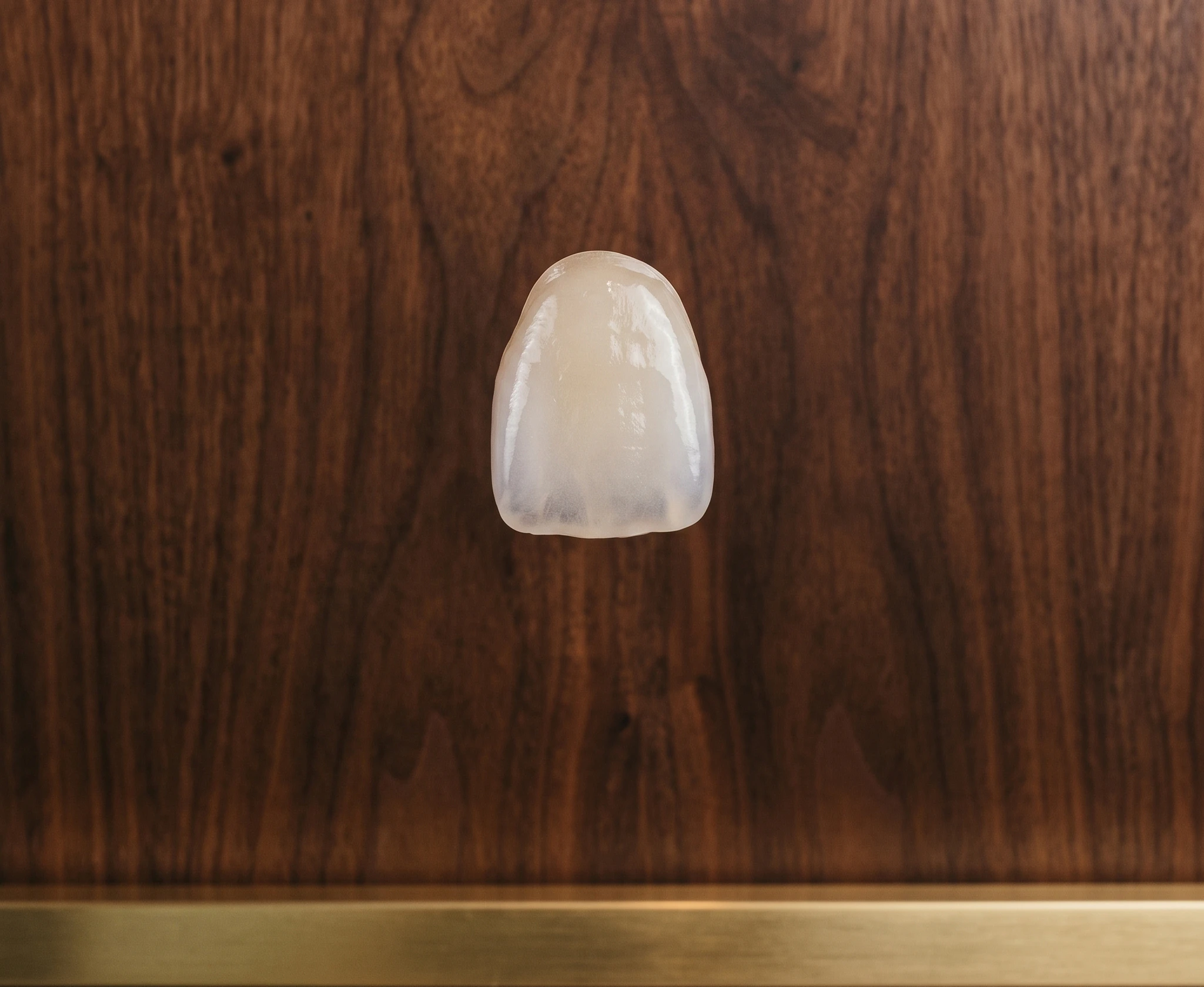 porcelain veneer