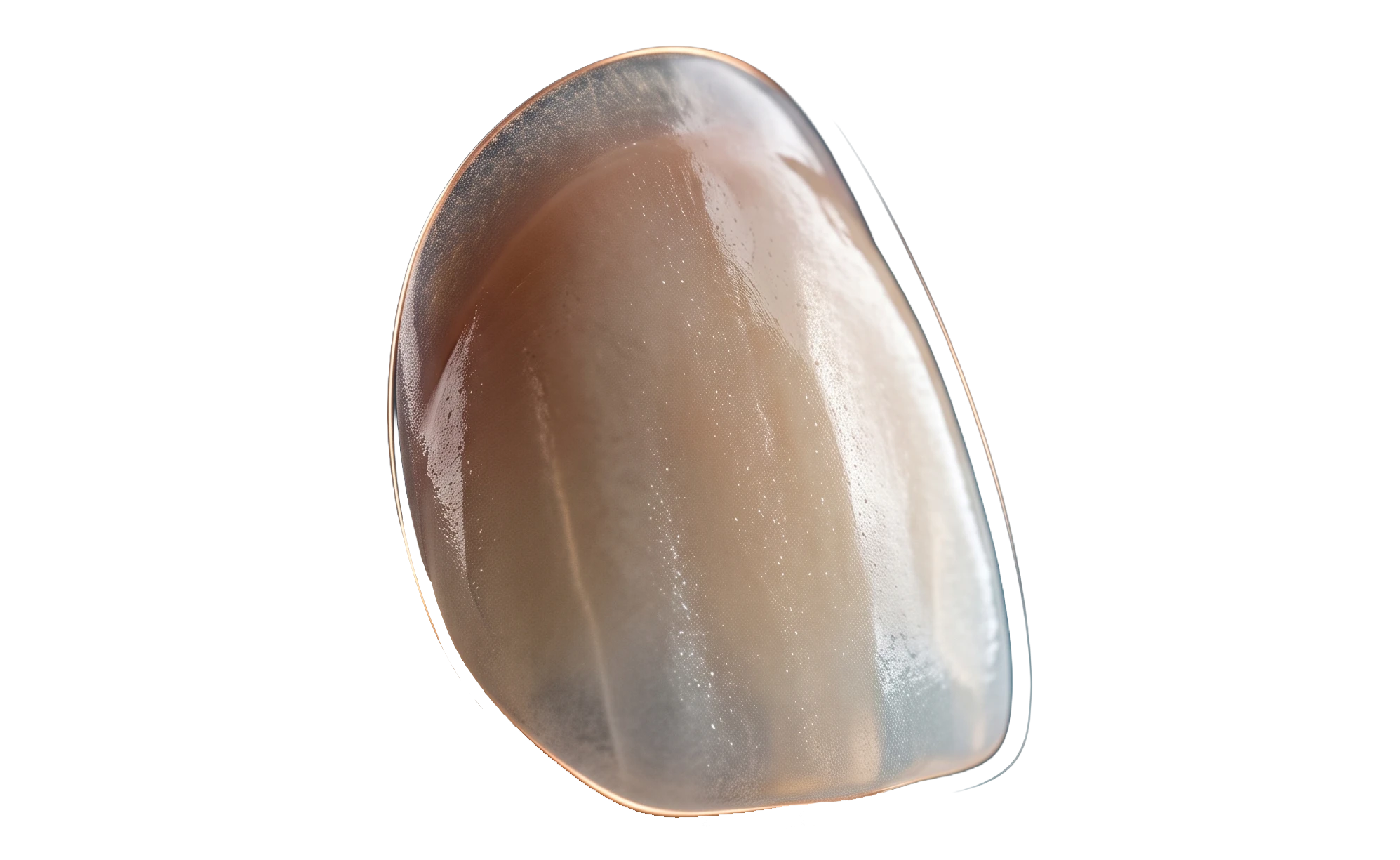 porcelain veneer