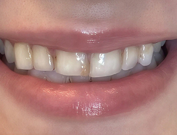 before dental treatment
