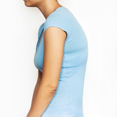 Woman with slouched shoulders